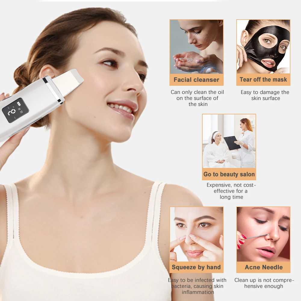 Home Beauty Instrument Ultrasonic Skin Scurporber Facial Spatule Blackhead Repose Trou Cleaner Commedo Extracteur de soulèvement Dispositif en profondeur Nettoyage et épluche Q240508