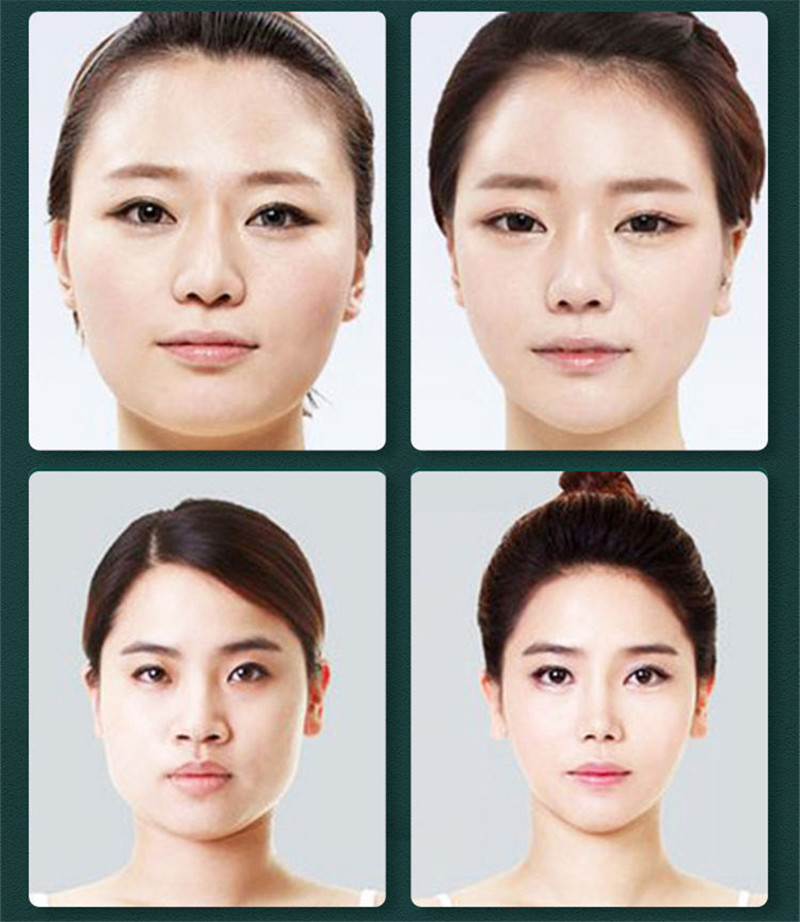 Facelifting-Massagegeräte für Gesicht Schlampenband Anti-Cellulite-Massagebaste Gesichtsmassage Muskelstimulator Massagebaste Gesichtsaufhebung