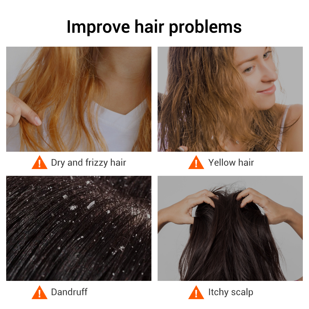 Ingwer handgefertigtes Haarwachstum Shampoo Seife kalte verarbeitete Seife Haar Shampoo Riegel rein pflanzliche Haar Shampoos Haarpflege