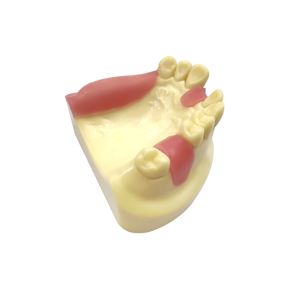 Модель липтерного имплантата с максиландией с модели обучения имплантации с мягкими десен для технического специалиста для стоматолога практики обучения обучению