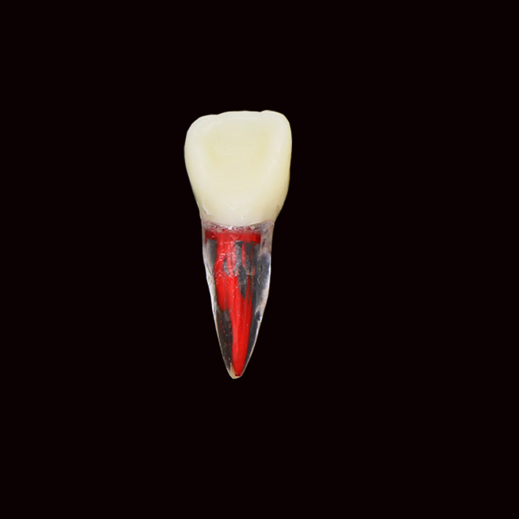 Modèle de canal racine de dents dentaire EndoDontic Fichier RCT Practice Block Pulp Cavity Training Labor pour l'étude de l'enseignement