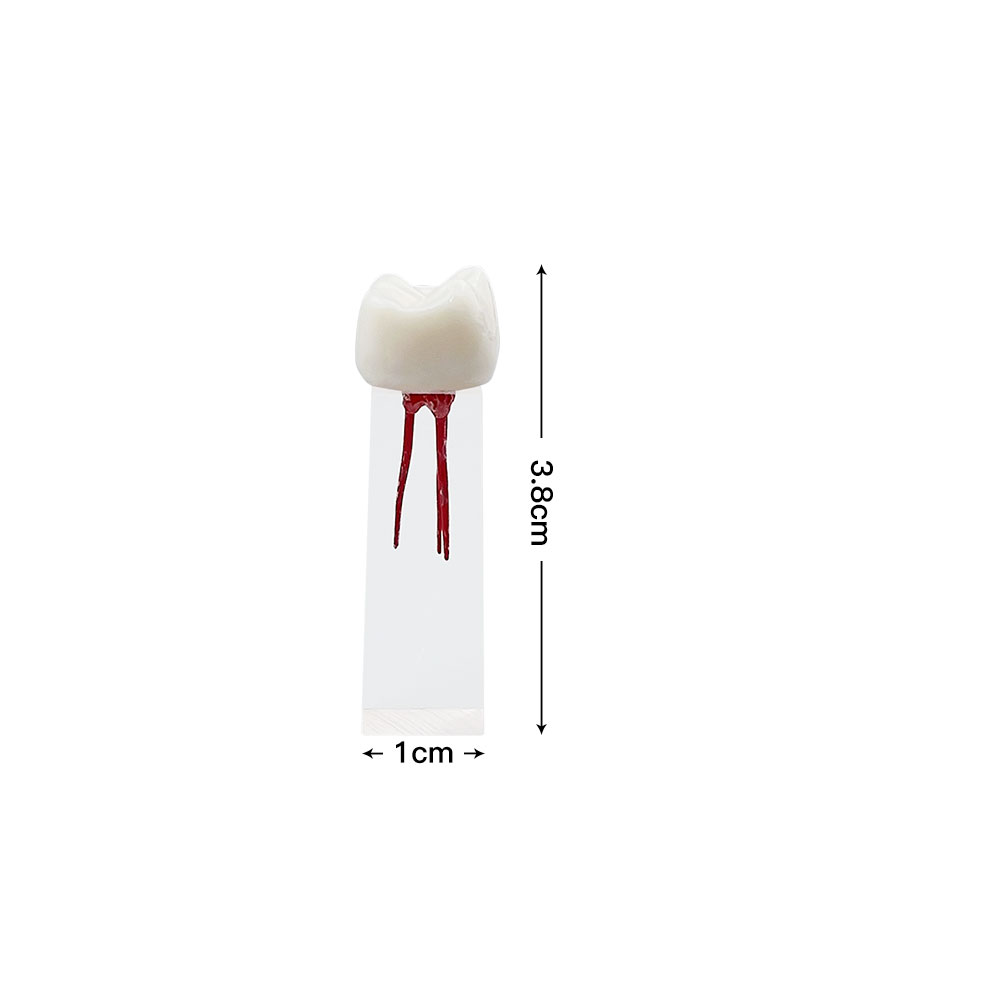 Modèle de dent de dent dentaire dentaires dentaires Modèle de démonstration de démonstration de la cavité de pâte endodontique pour les outils de dentisterie d'étude des étudiants dentiste