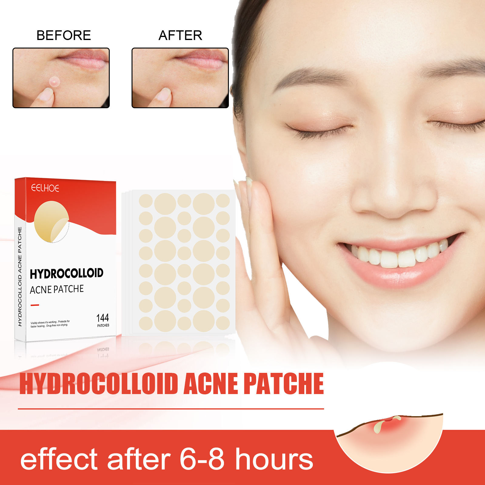 Acne Pimple Master Patch Acne Pimple Remover Patches Invisible Spot Absorberen Cover Skin Protective Stickers Huidverzorging