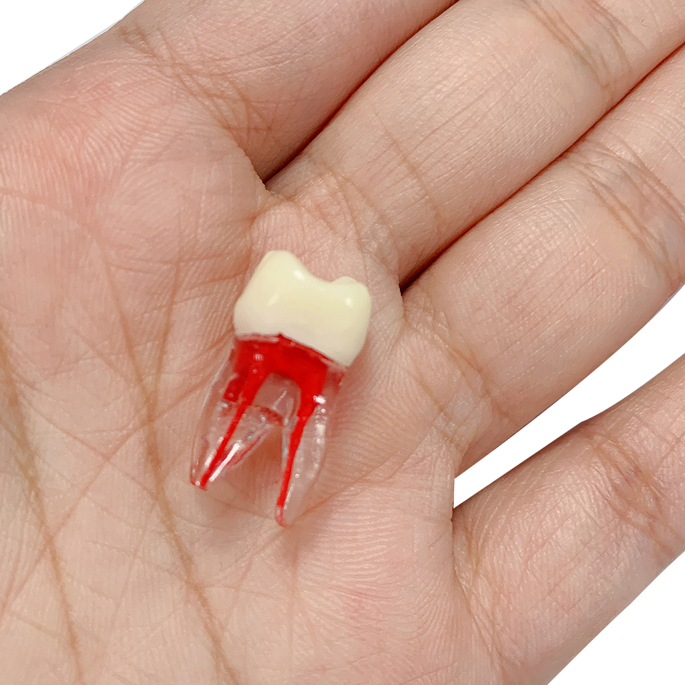 / dentaires dentaires Modèle d'étude d'enseignement endodontique Modèle de cavité de dentiste