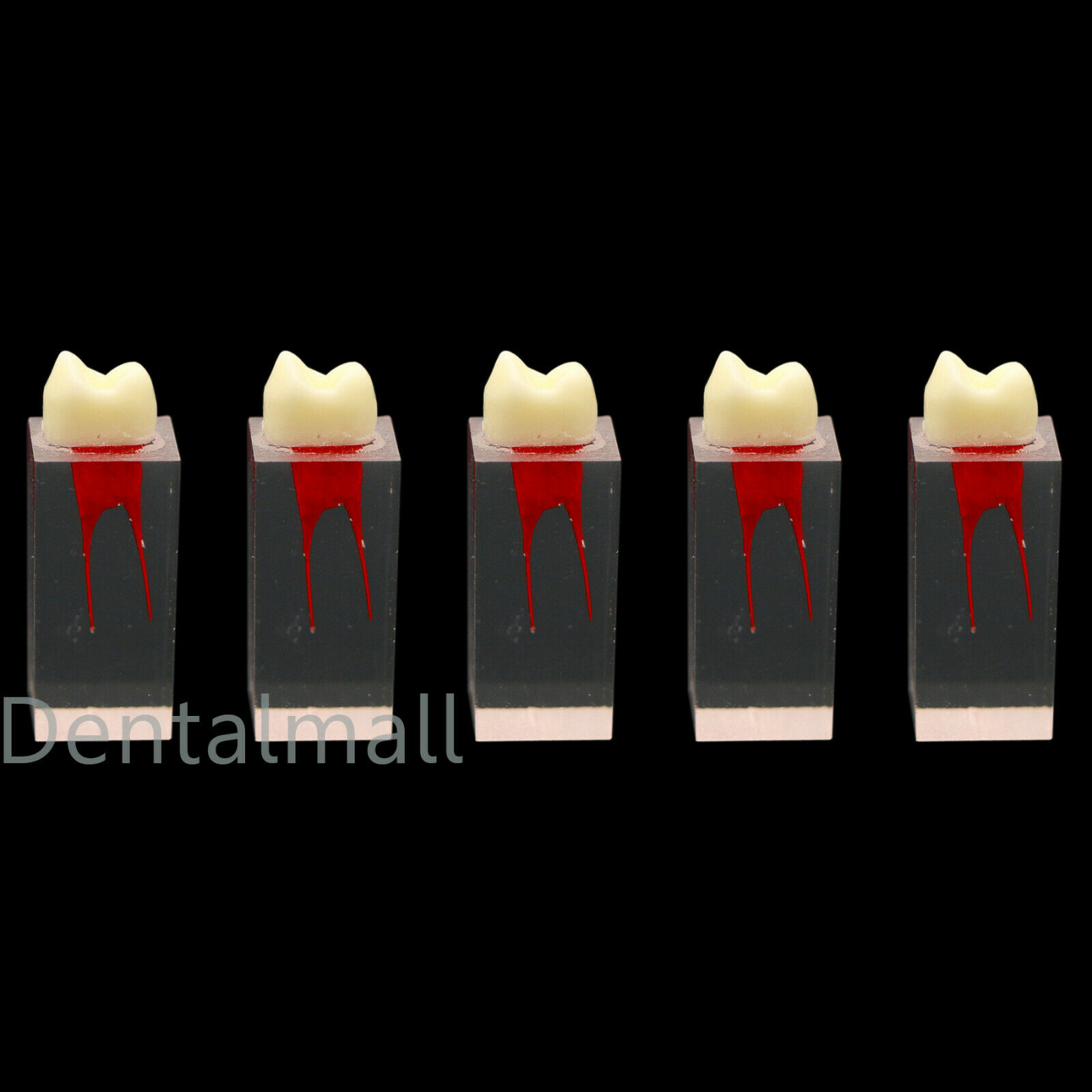 Dental Root Teeth Teeth Molar Model Practice Practice pour le fichier de pâte endodontique