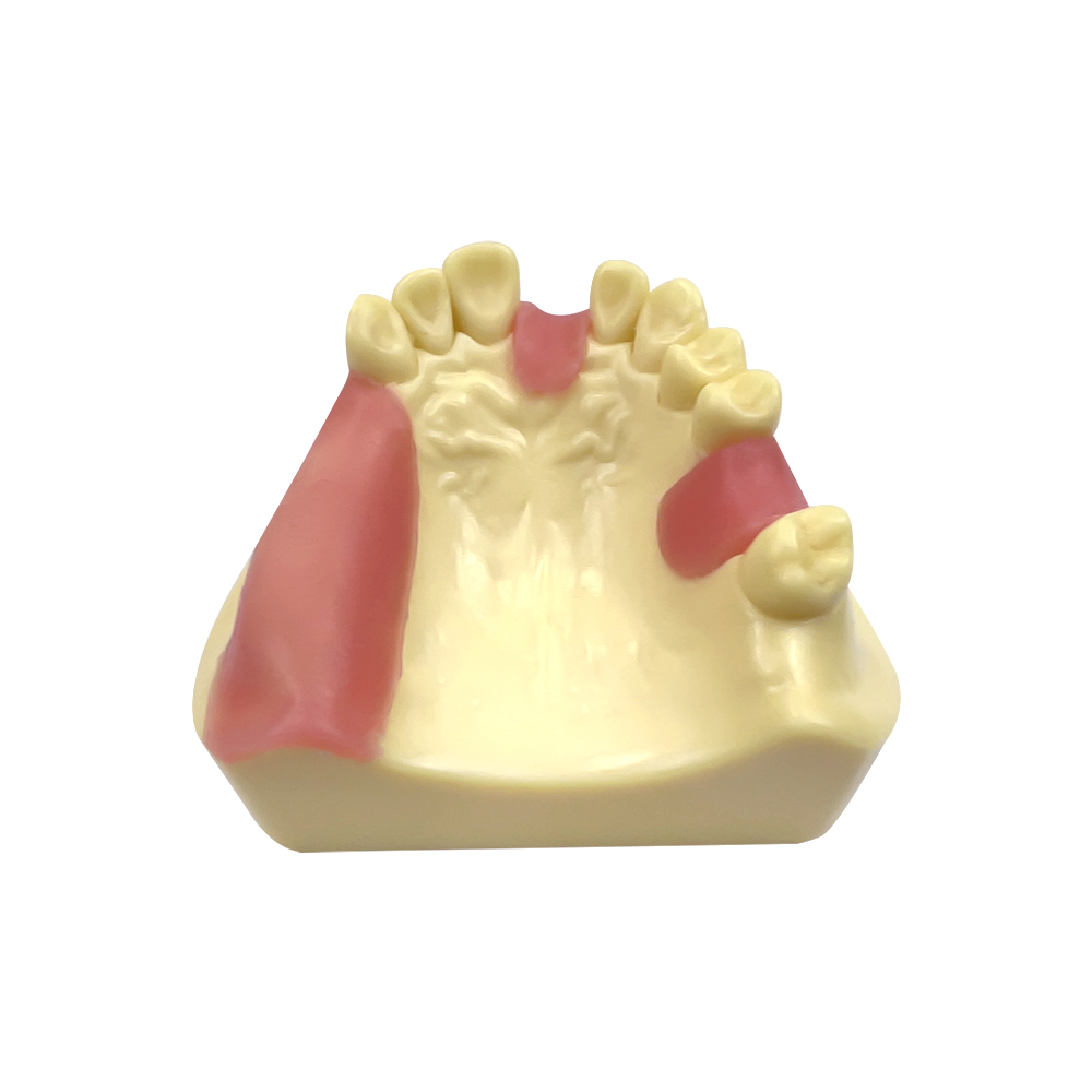 Maxillair implantaatmodel met zacht tandvlees implantaatonderwijsmodel voor tandheelkundige technicus praktijk training studeren model