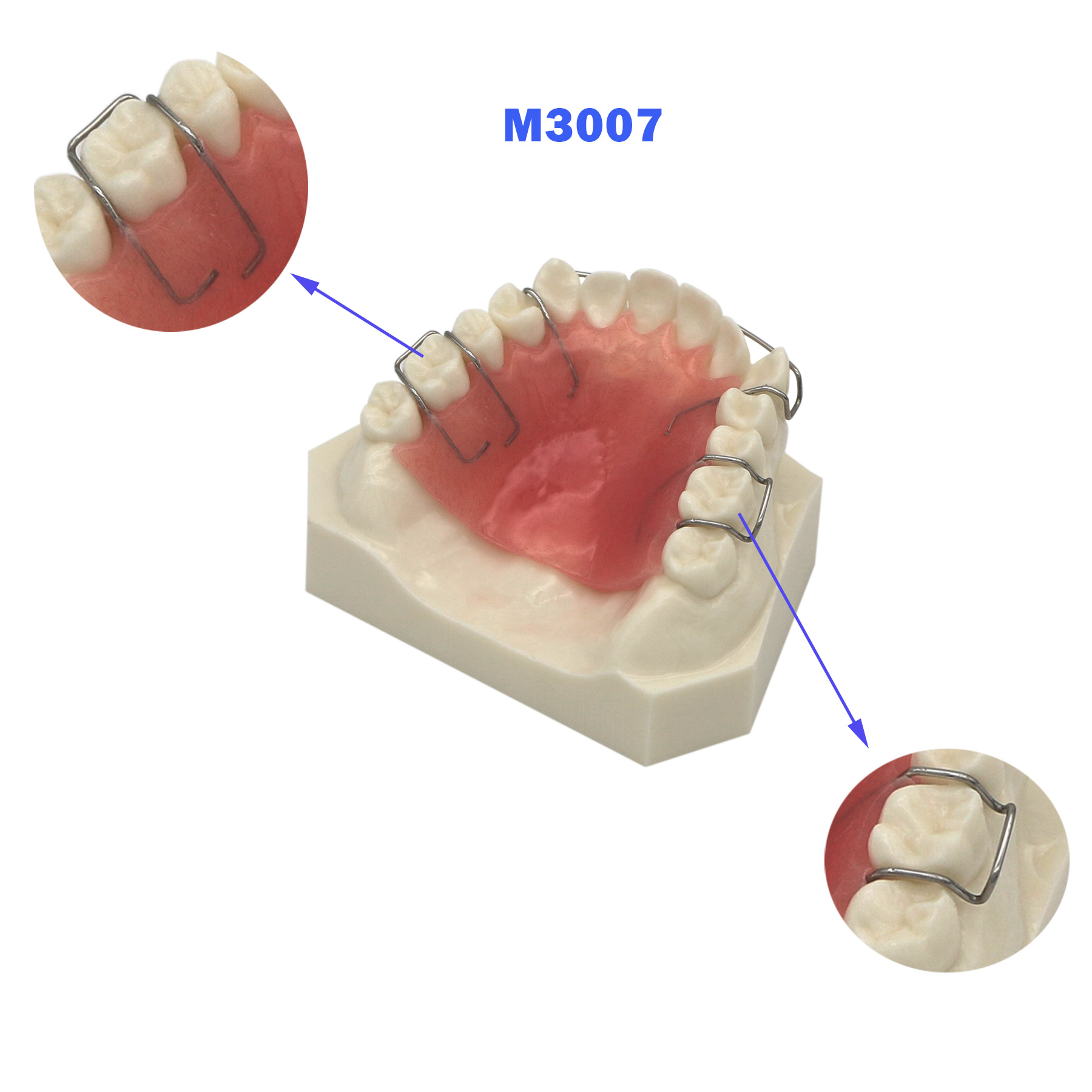 Modèle de dents dentaire avec hawley retenue étude orthodontique dentaire enseigner la démo bionator amovible pour la dentisterie M3007