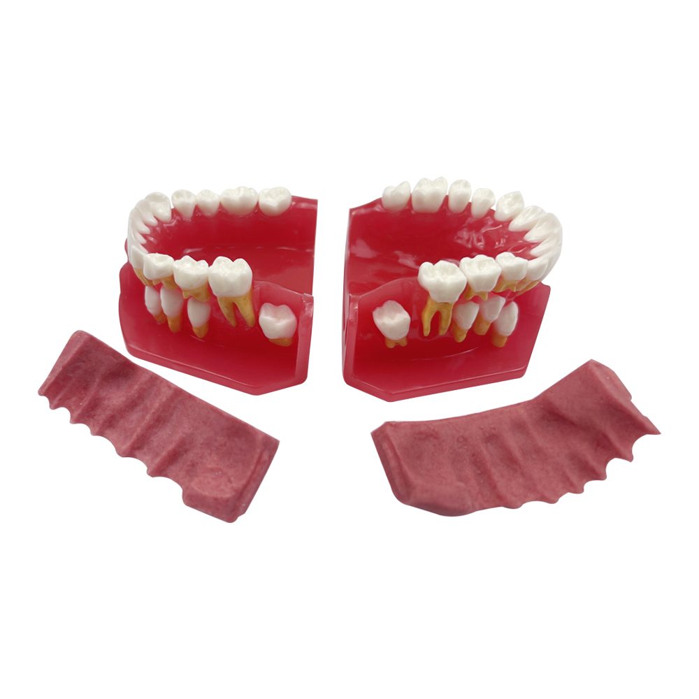 Modèle d'enseignement dentaire amovible Modèle dentaire à feuilles caduques pour les enfants pour étudiant dentiste étudiant la formation en pratique