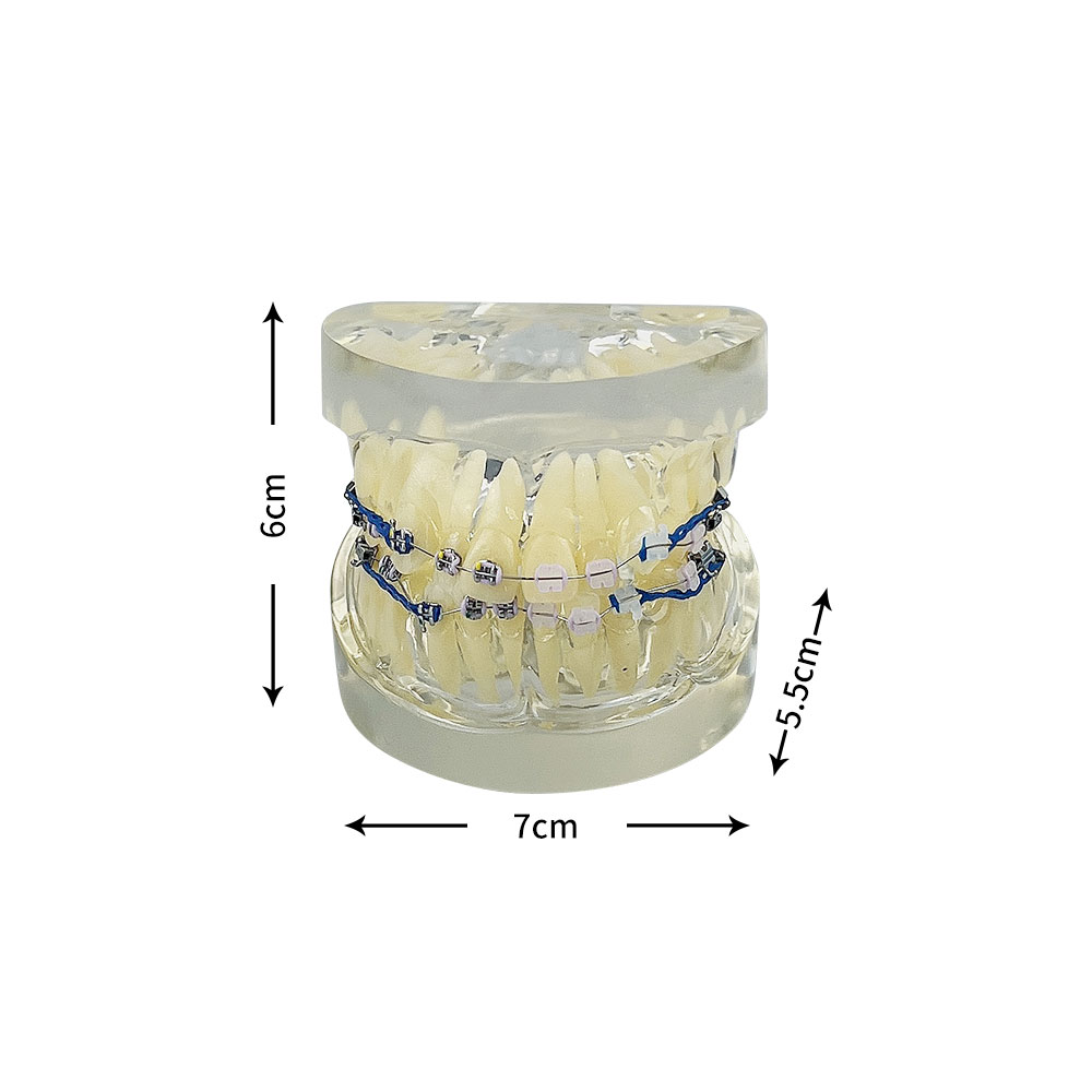 Modello di denti Modello ortodontico dentale il tecnico dentista Dental Dental Studying Communication medico-paziente