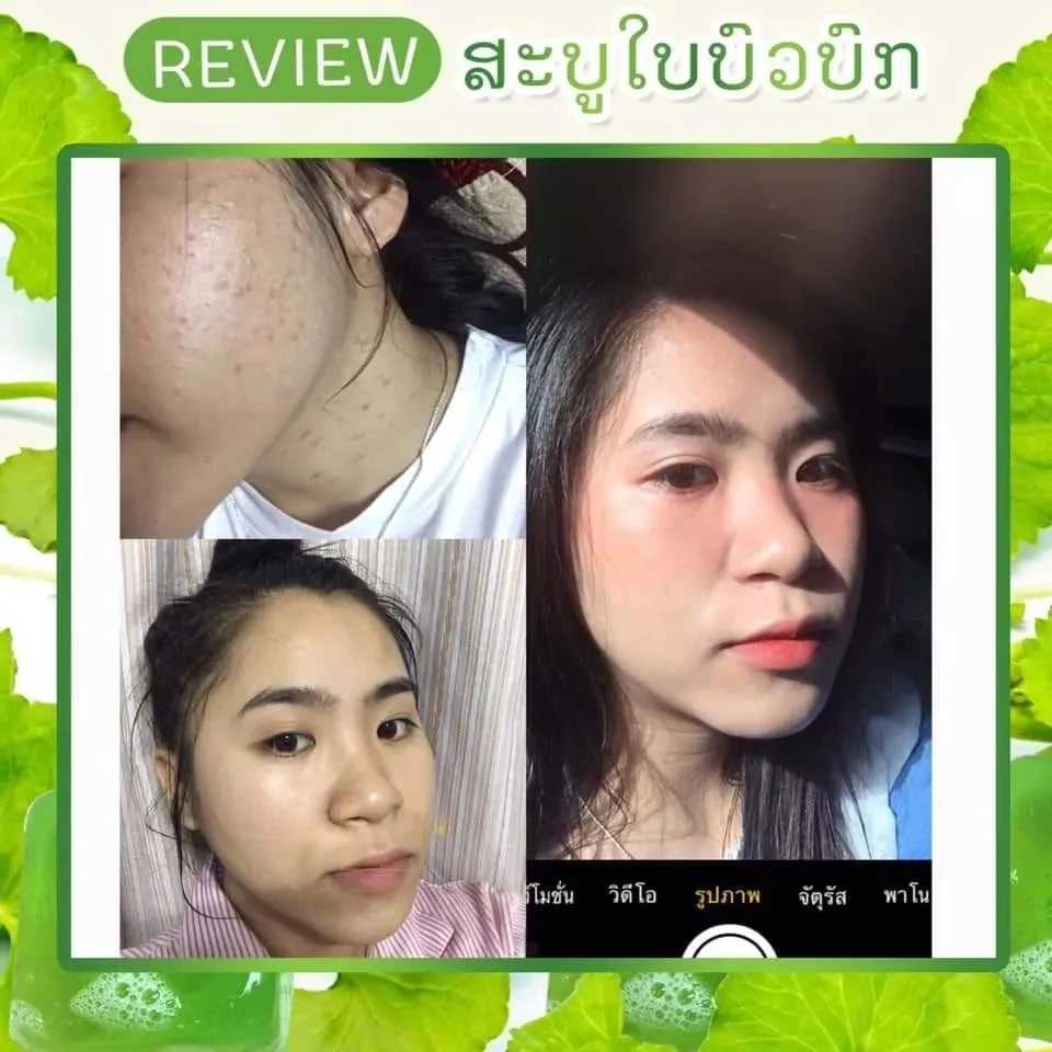 Handgemaakte zeep Thailand cica revitaliserende zeep verminderen acne donkere vlekken vocht heldere huidporiën strakker worden glad en zacht gevoelige huid 50 g 240416