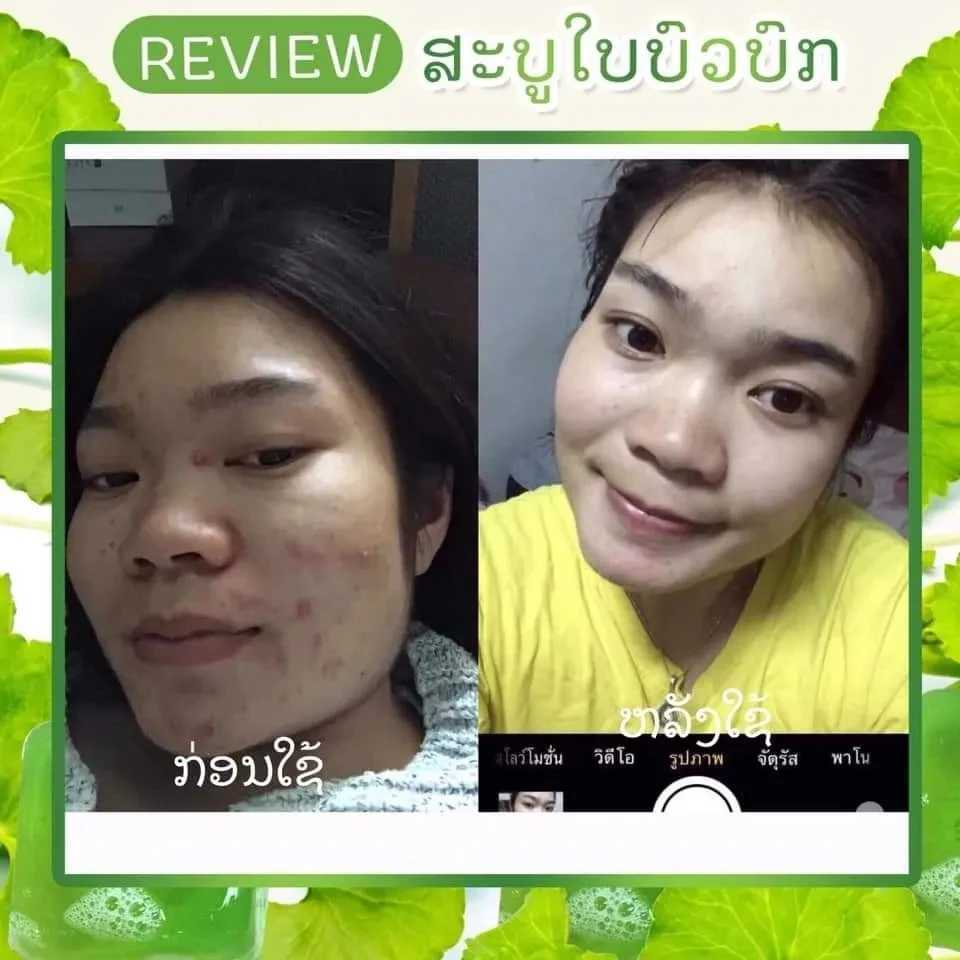 Handgemaakte zeep Thailand cica revitaliserende zeep verminderen acne donkere vlekken vocht heldere huidporiën strakker worden glad en zacht gevoelige huid 50 g 240416