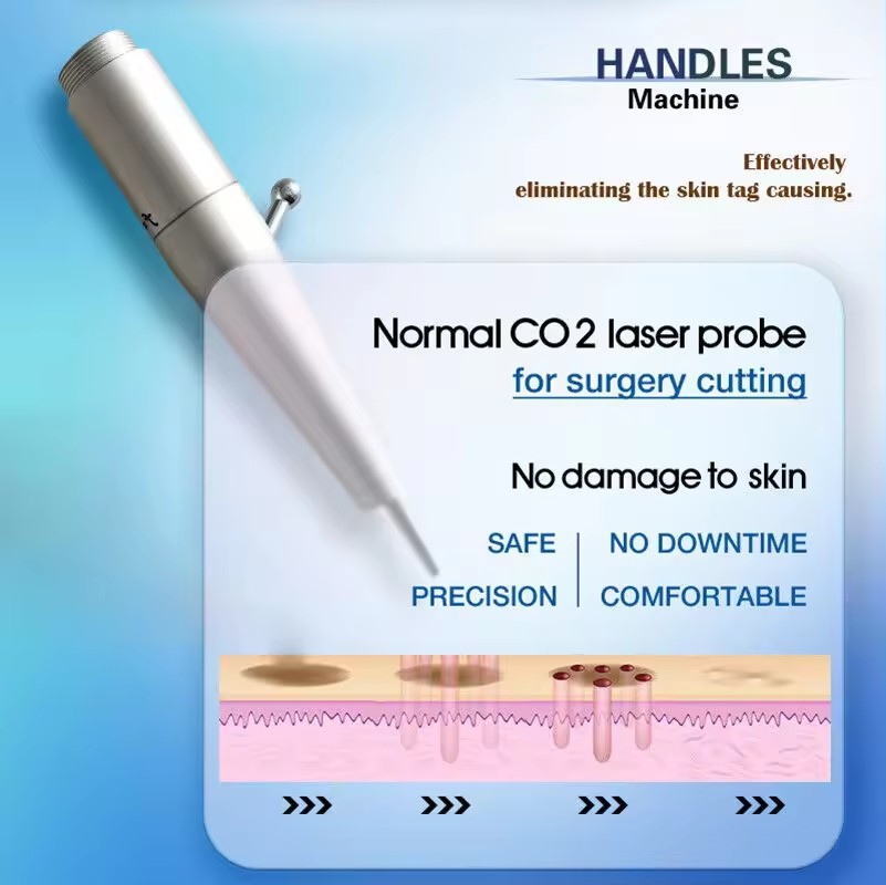 Beste Qualität HF CO2 BRACTIONAL LASERLASERNETZUGFREIDUNG RESURFACKING VON JUVENATION ACNE NARTE Wrinkelnentfernung CO2 Lasermaschine