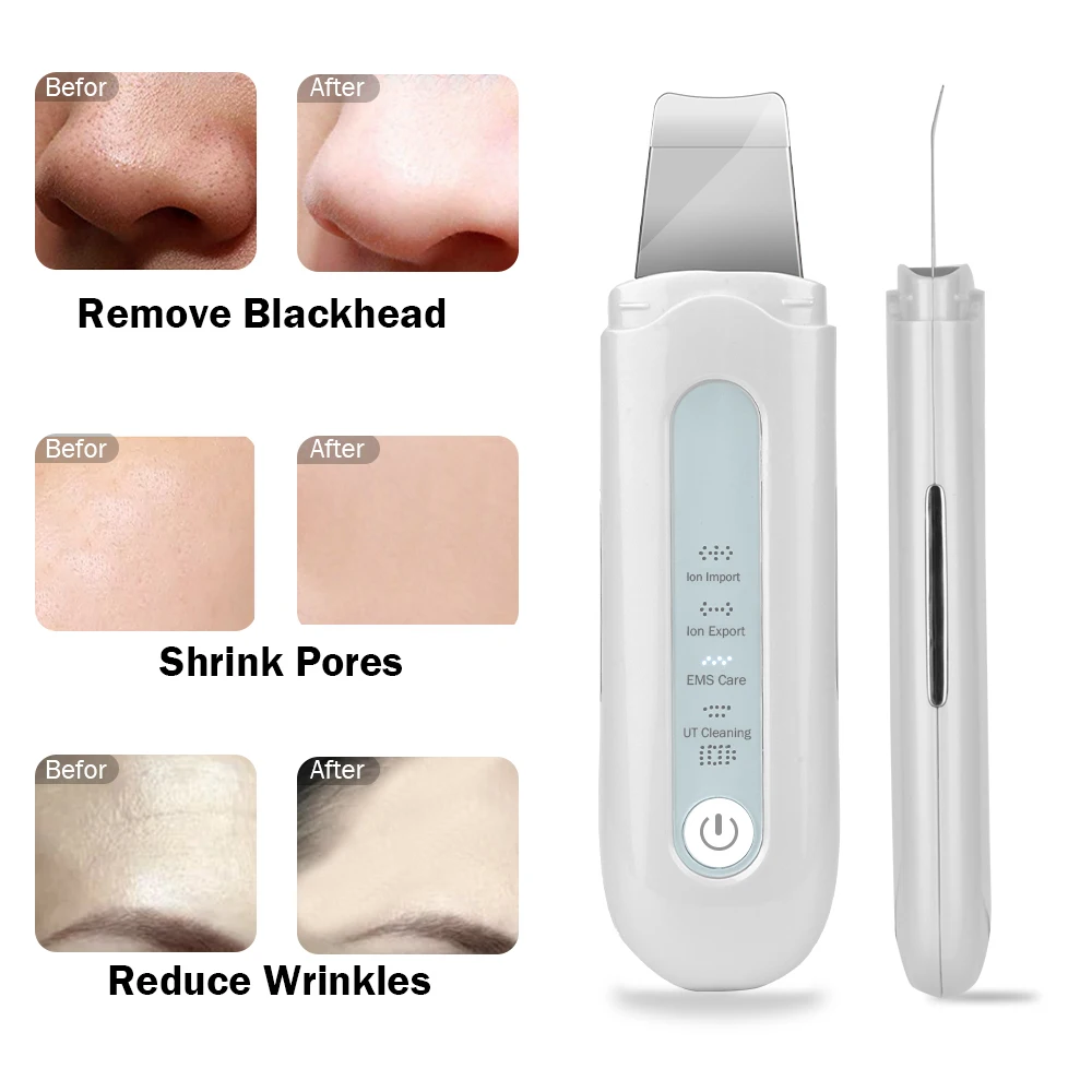 Acessórios purificador da pele ultra-sônico recarregável íon profunda limpeza facial vibração massageador acne remoção de cravo limpador cuidados faciais spa