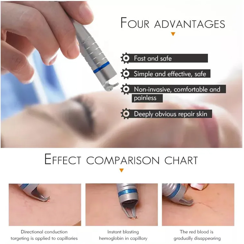 980NM 1470NM ENDOLASER SLAMMING MASKIN ENDOLIFTNG LASER LIPOLYS FAT REDUCTION Dubbelhaka Borttagning Vaskulär borttagning Ven Borttagning