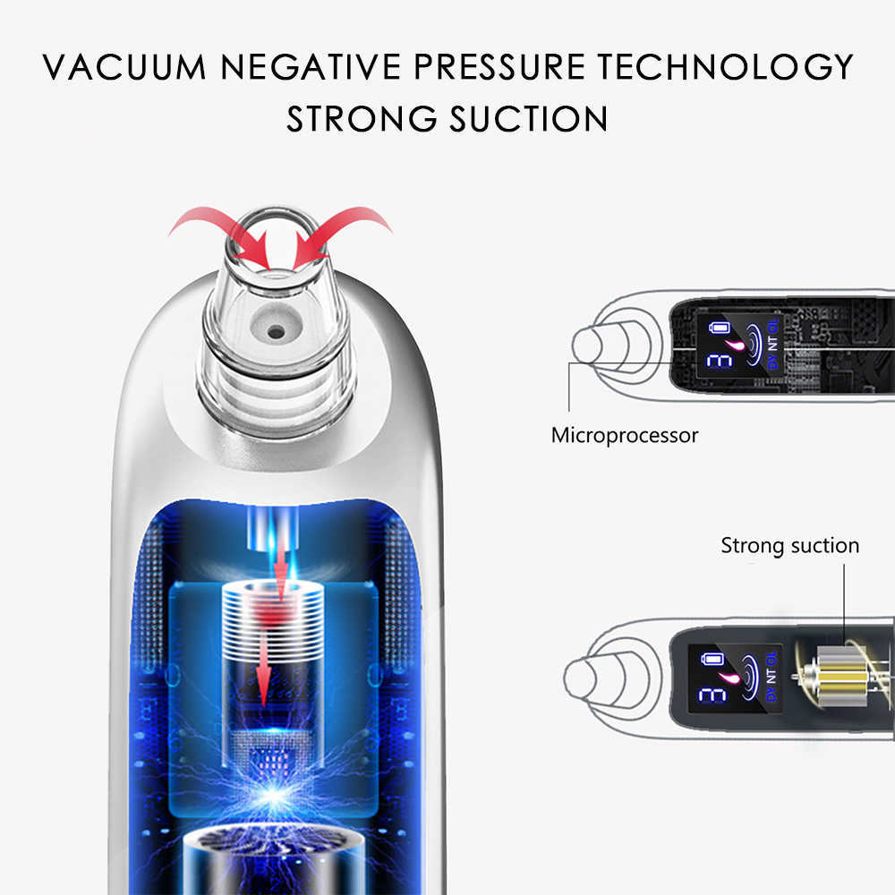 Dispositifs de soins du visage Dissolvant de points noirs Aspirateur de pores Boutons Dissolvants d'acné Nez électrique Points noirs Instrument de nettoyage 230915