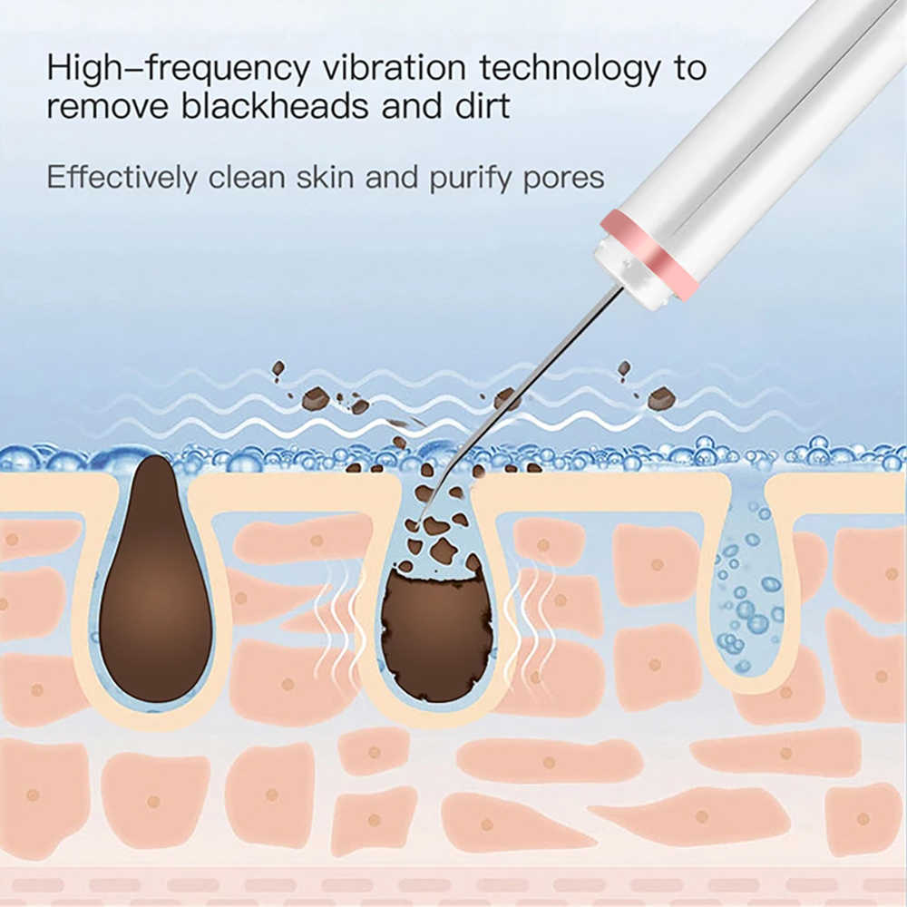 Face Care Devices Ultrasonic Skin Scrubber Spatula Shovel Ion Deep Cleaning Blackhead Removal Pore Cleaner Lift Beauty Machine 230915