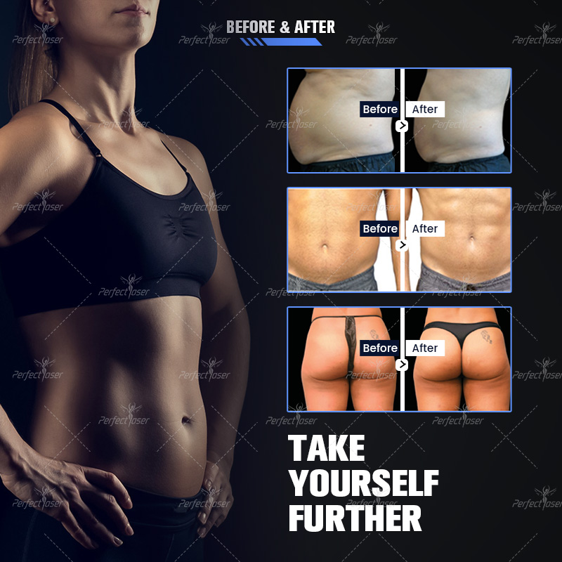 プロのEmslim Neo rf 16 Tesla Muscle Building Body Slimming装置