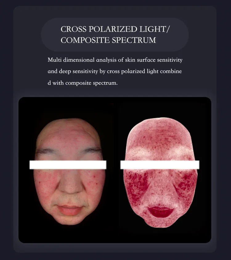 매직 미러 스킨 분석기 얼굴 범위 분석 기계 얼굴 진단 시스템 AI 얼굴 인식 기술 HD 픽셀 페이셜 테스트 보고서