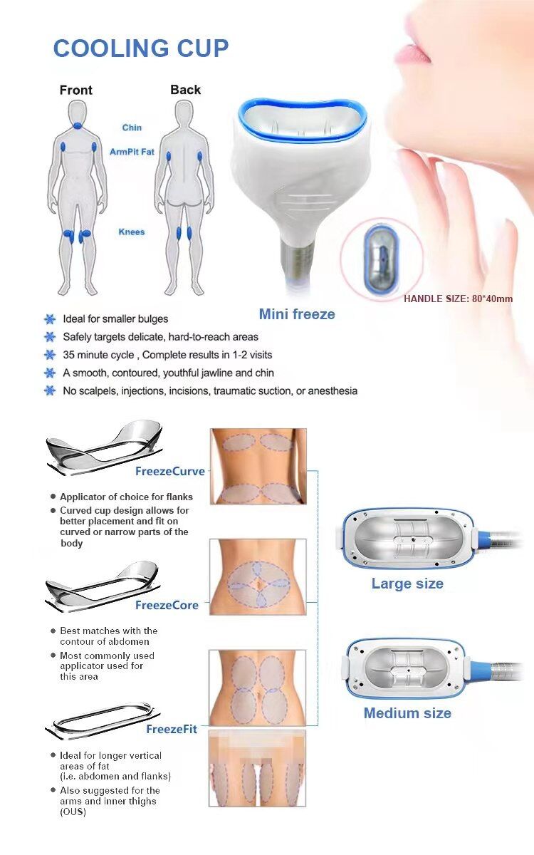 Profesional multifuncional 360 grados grasa congelada 4 procesamiento de grasa congelada tratamiento máquina de eliminación de celulitis solubilización máquina más delgada