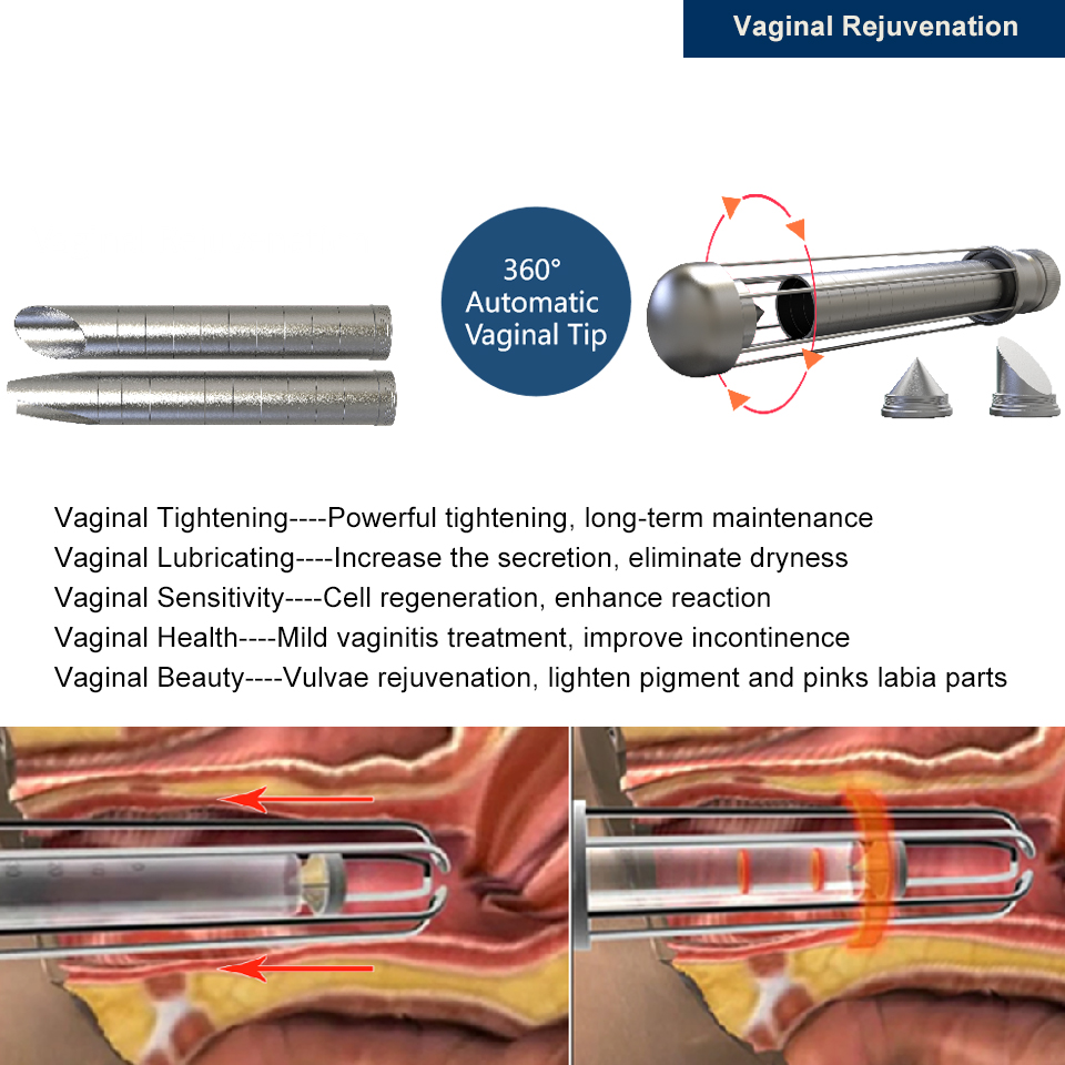 Macchina laser frazionata CO2 da 70 W il resurfacing e il rafforzamento della pelle Dispositivo laser coerente USA