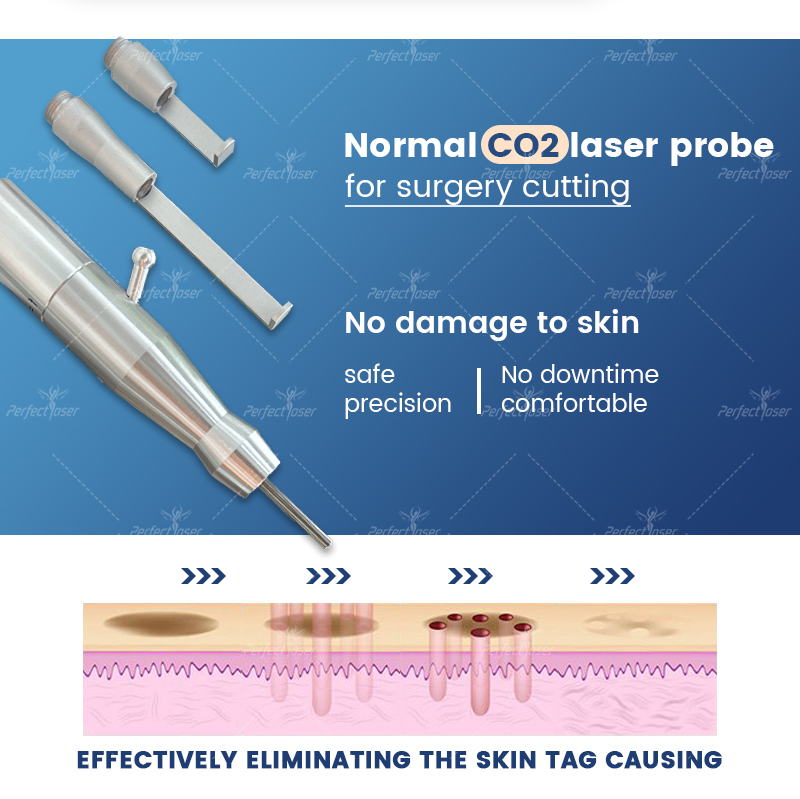 Dot Matrix Laser CO2 fractionnel élimination des taupes laser fractionné visage machine d'élimination du laser 10600nm élimination des vergetures CO2 laser salon utilisation 2 ans de garantie