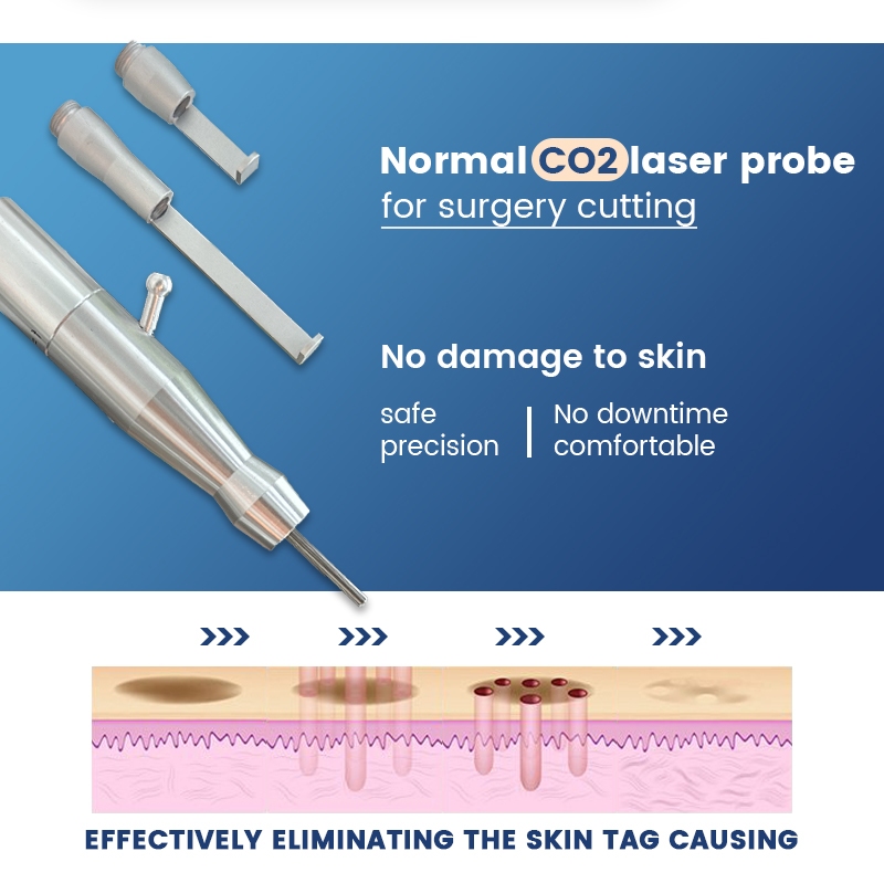 60W fraktionerad CO2 Lasermaskin ärr Stretch Marks Borttagning rynka behandling CO2 laser akne RF metallrör huden återupptagande