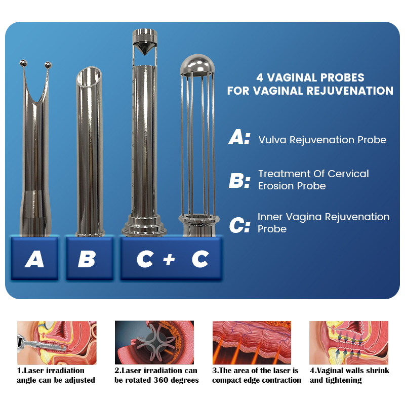 Terapia fracionária de CO2 terapia de carbono dióxido de lazer Peel Machine rejuvenescimento rejuvenescimento facial Redução de tratamento de aperto vaginal