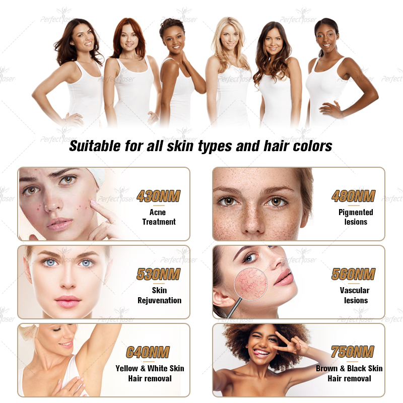 CE Approved IPL OPT laser hair removal permanently nd yag lazer tattoo remove multifunction machine rf face lift elight