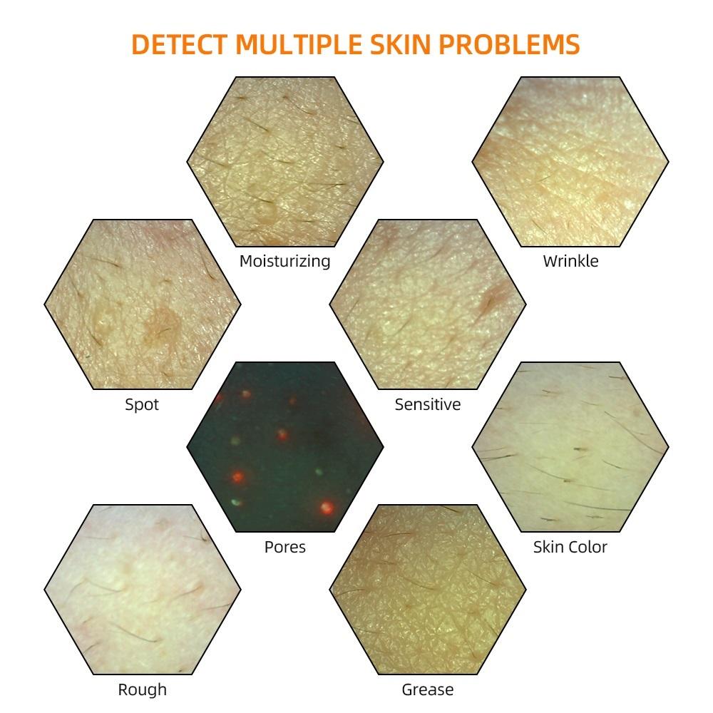 Analyzer la pelle professionale Macchina Salone di bellezza UV Light Dermis Tester Epidermide 50x Numinifier ingrandimento Wrinkle Grease Pori Microscopio