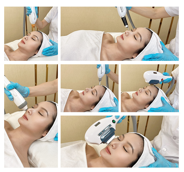 Multifunctioneel ontharingapparaat apparaat Elight RF Picoseconde Laser Skin Beauty Machine