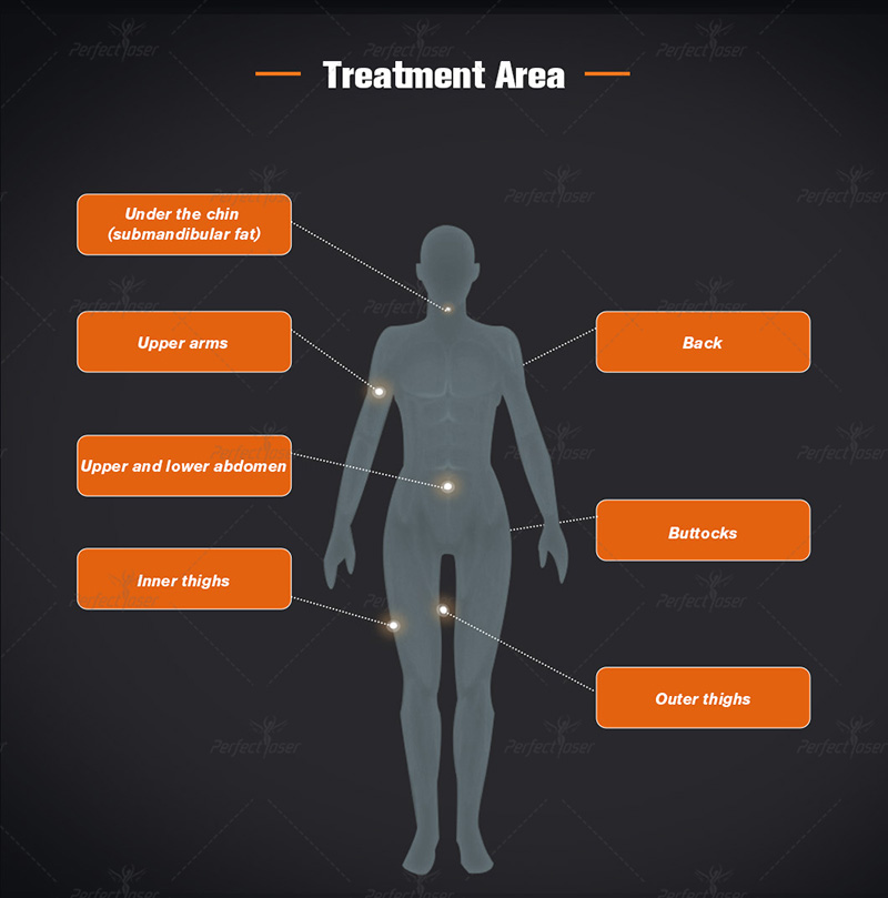 Lifting Trusculpt Rajeunissement du corps Élimination des graisses Réduction des graisses Cellulite 2 Mode de fonctionnement Mise au point monopolaire RF + MDS Machine à radiofréquence