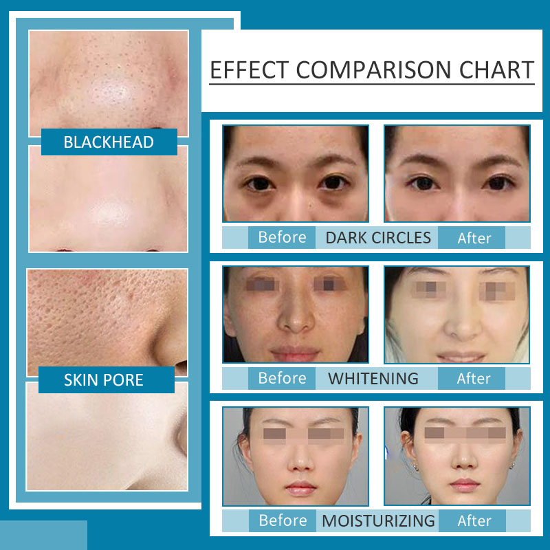 Wielofunkcyjny sprzęt kosmetyczny Maszyna twarzy do twarzy tlenowej 7 w 1 mikrodermabrazji Zarządzanie Analizatorem skóry Analizator twarzy dla salonu piękności