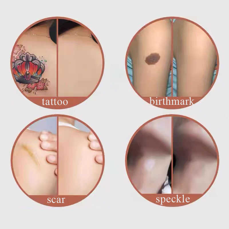 Temporära tatueringar Nya 6st Tattoo Cover Up Skin Color Scal Concealer Klistermärke Portable Flaw Birth Mark Dolda vattentäta skönhet Kosmetiska verktyg Z0403