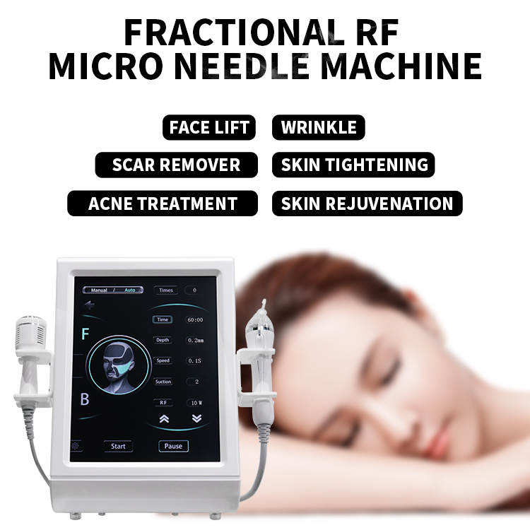 2 I 1 RF Microneedle Machine med ishammer Fraktionerad mikronedling kroppslyft Acne ärrbehandling rynkor stretchmärken Remover Micro-Needle Facial Care Device