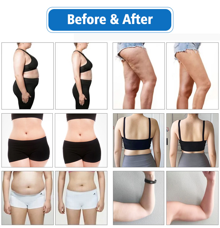 Nyaste heta 10D Lipo Laser Slimming Machine Laser Lövsduktion Burning Fat Body Shape Lipolaser Equipment CE Godkända Cryo Pads EMS Multifunktion