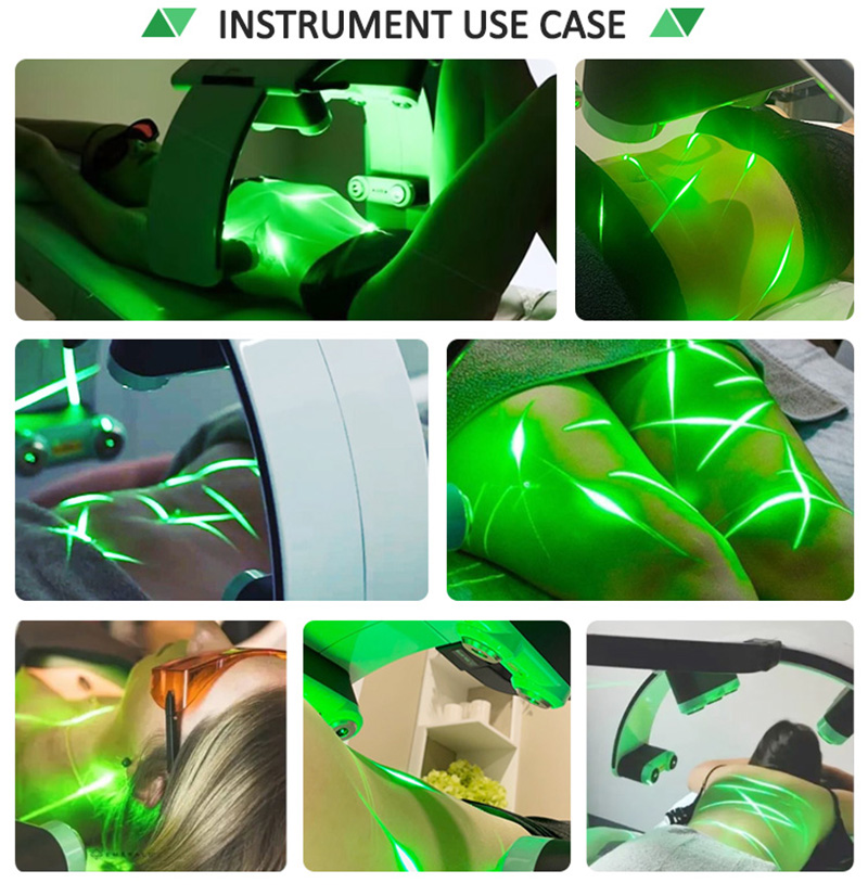 Luxmaster Laser Emerald Laser Fat Removal For Commercial 10D Laser Body Shape Machine Laser Slim