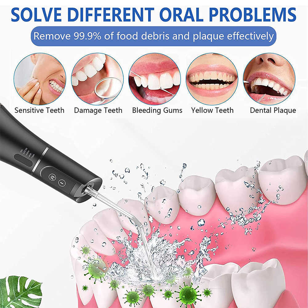 구강 관개 기타 위생 치아 치아 치아 치아 미백 휴대용 관개 치아 세정 도구 무선 픽 400ml 221215