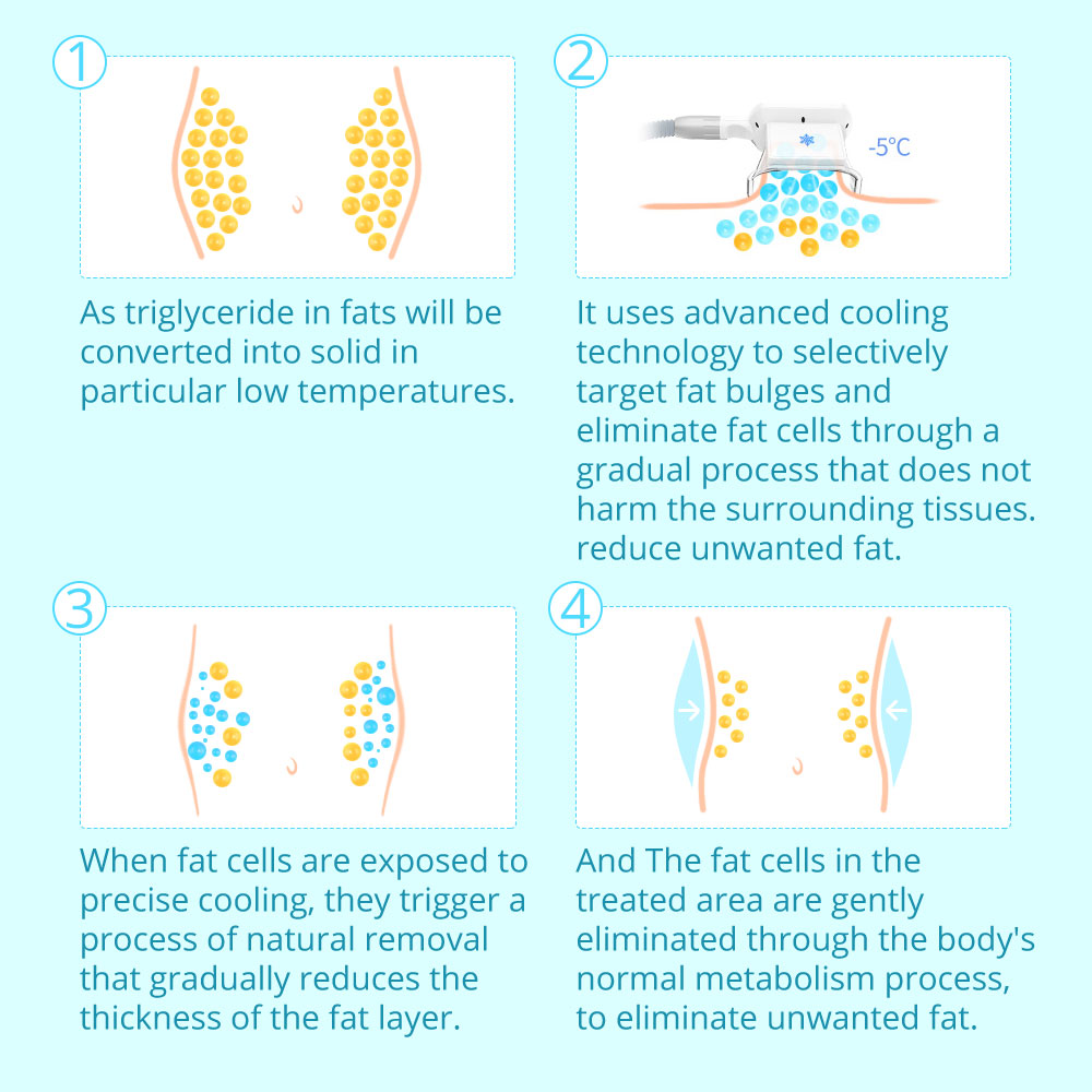 듀얼 핸들 Cryolipolysis 슬리밍 기계 휴대용 Cryotherapy Fat Freeze Criolipolisis Maquina