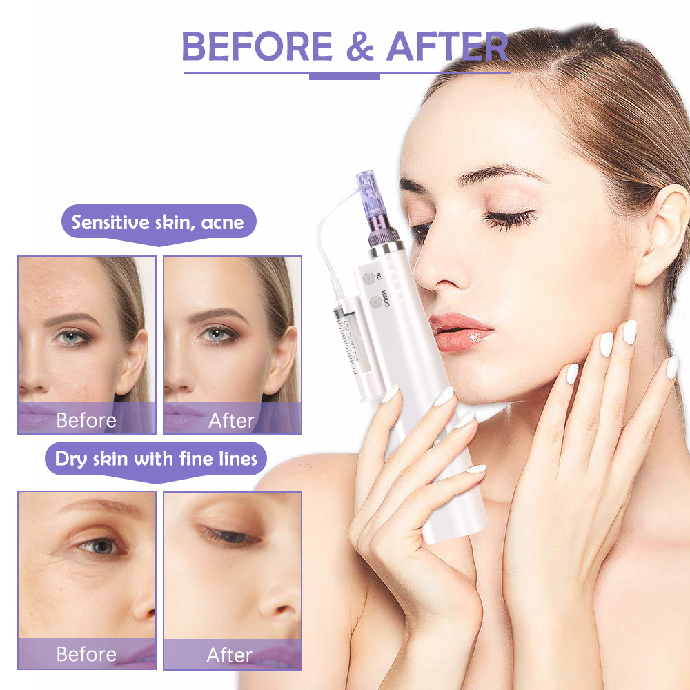 Microneedle Pen Derma Pen LED 5 Vitesse Auto Microneedling MTS Mésothérapie Soins de la Peau Dermapen Micro Cartouche