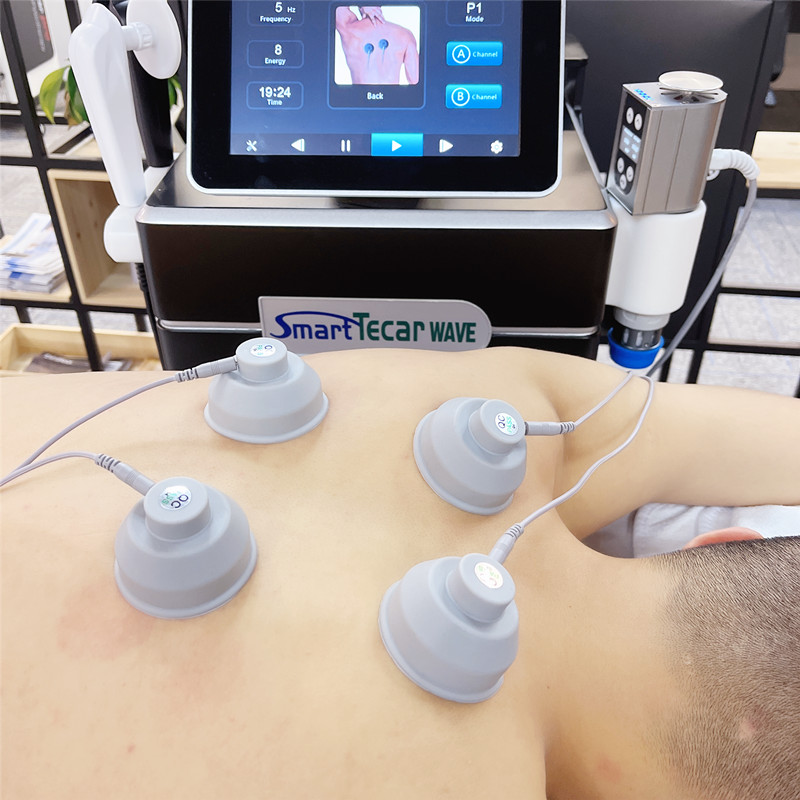 Máquina de terapia por ondas de choque para tratamento de emergência 3 em 1 Smart Tecar Wave Alívio da dor