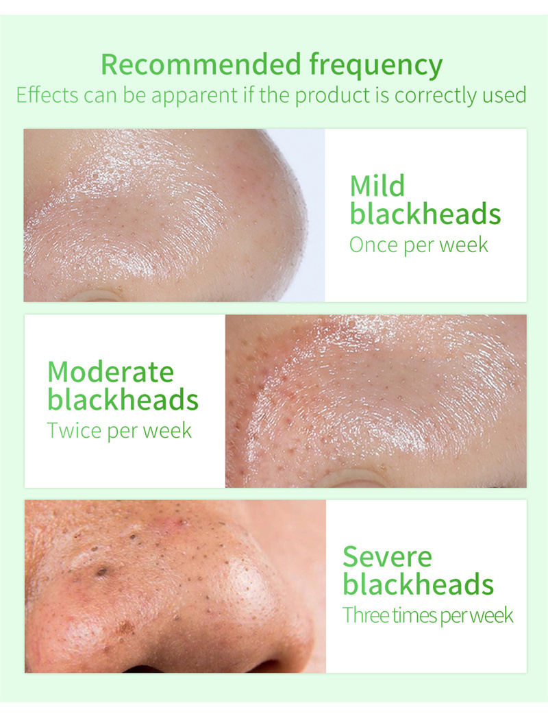 Lanbena blackhead remover skala av mask 3 i 1 gr￶nt te olje blackhead borttagningssats f￶r porer n￤schins ansikte sk￶nhetsupps￤ttning