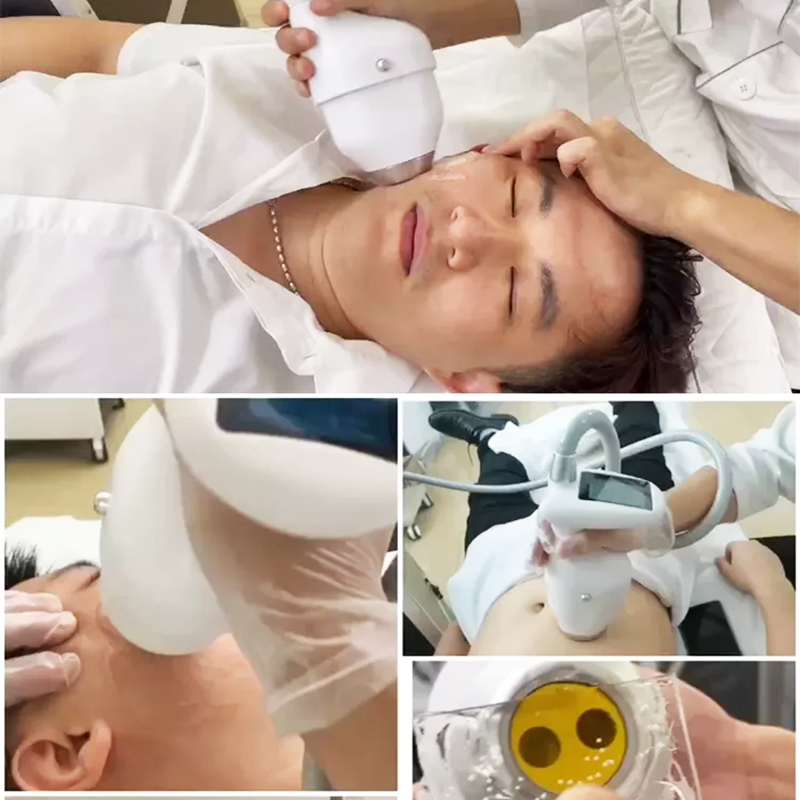 Ice HIFU Beauty Equipment 62000 Shots Cryo Ultrasound Salon Use Weight Loss Body Sculpting Anti-wrinkle Neck Lifting Body Sliming