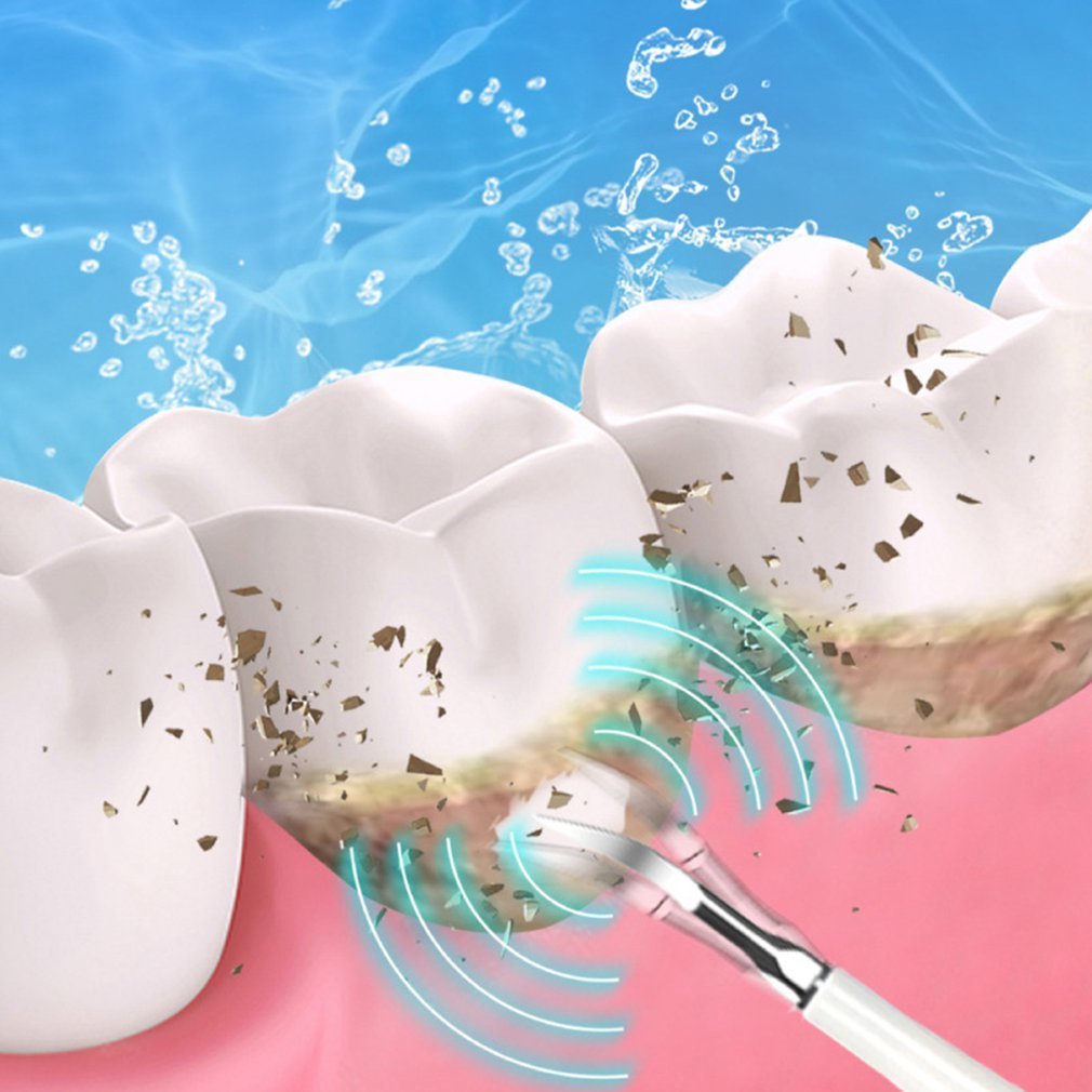 その他の経口衛生電気超音波歯科微積分除去歯クリーナークリーニングホワイトニングタルタルケア221101