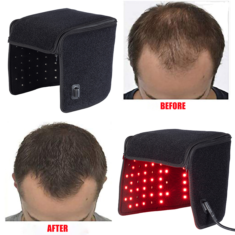 Gesichtspflegegeräte Infrarot-Rotlicht-Therapiekappe 215 Lampe Haarwuchshelm Anti-Haarausfall-Behandlung Haarfollikel Heilung Haarpflege Kopfbedeckung 221104