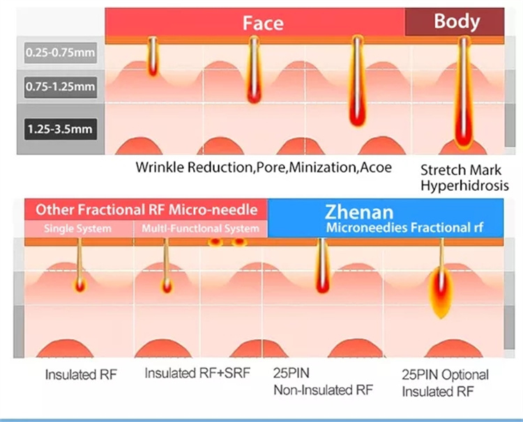 Cuidados com a pele profissional Radiofrequência de levantamento de rosto FRACIONAL MICRONEEDLE RF com martelo frio