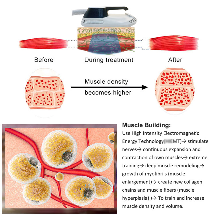 hiemt emslim 1 핸들 체형 증가 근육질 근육 지방 감소 EMS 근육 아티 미터 슬리밍 머신 CE 인증서