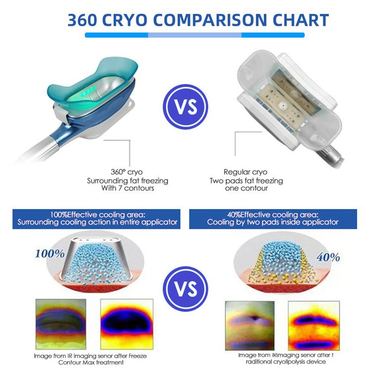 360 cryo machine de congélation des graisses cryolipolyse cool tech gel minceur système criolipolisis laser lipo cavitation liposuccion sous vide cryothérapie cryolipolyse