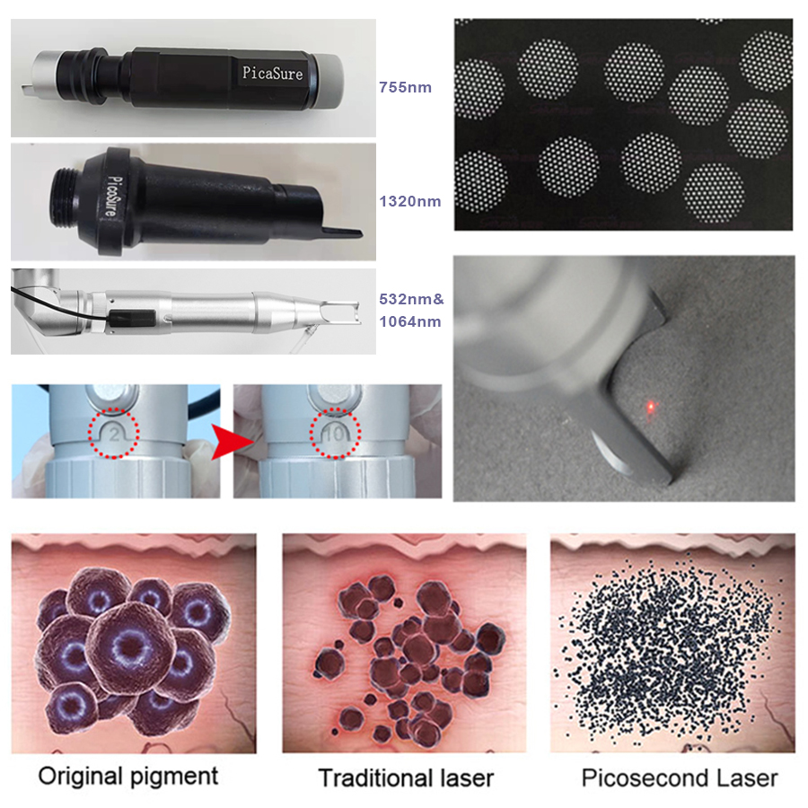 Picoseconde Laser Machine détatouage Pigment Laser tache de rousseur supprimer le traitement de l'acné 532nm 755nm 1064nm 1320nm peau de carbone