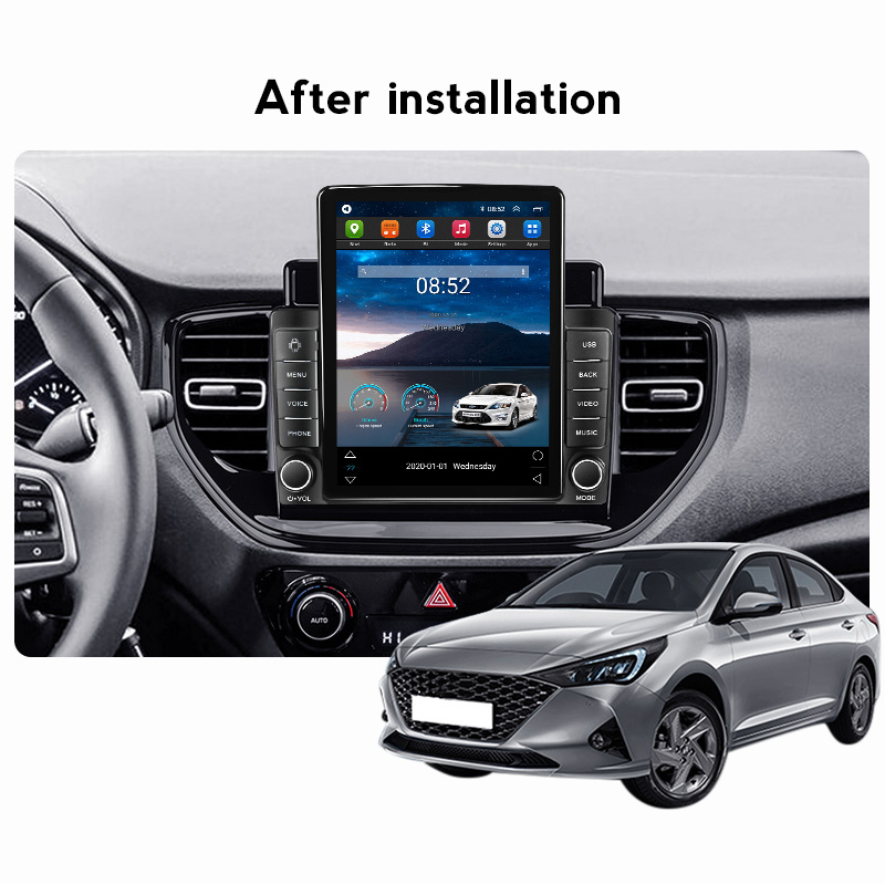 CAR DVD -videospelare CarPlay Android 11 för Hyundai Solaris Accent 2 II 2020 - 2021 Multimedia Stereo Navigation GPS Radio