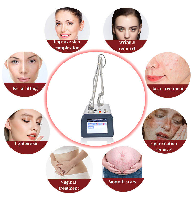 Laser Machine Fractional Co2 Acne Scar Removal Vaginal Tightening Fractional ND YAG Face Lifting Pigment Wrinkle Remover Beauty Equipment For Salon